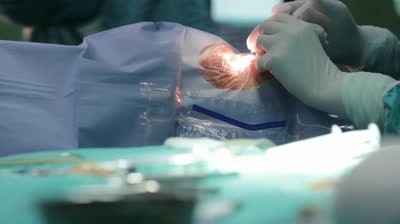 cataract cataract